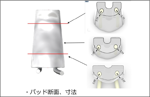 血管走行断面図