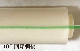 100回穿刺後
