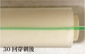 30回穿刺後